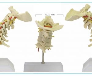 Coluna Vertebral cervical
